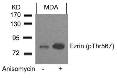 Western Blot: Ezrin [p Thr567] Antibody [NB100-81918]